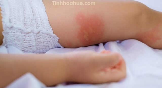 cách phân biệt dầu tràm thật giả